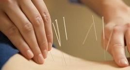 acupuncture dry needling sacroiliac joint